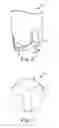 Fig. 03 - Implant positioning systems for orienting prosthesis