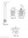 Fig. 08 - Implant positioning systems for orienting prosthesis