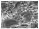 Fig. 01 - Methods for modifying the surface of an implant to provide said surface with calcium