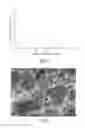 Fig. 02 - Methods for modifying the surface of an implant to provide said surface with calcium