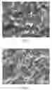 Fig. 03 - Methods for modifying the surface of an implant to provide said surface with calcium