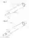 Fig. 02 - Removable and/or retrievable stents and kits