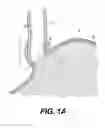 Fig. 02 - Tissues patches and related delivery systems and methods
