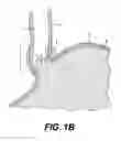 Fig. 03 - Tissues patches and related delivery systems and methods