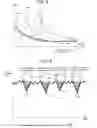 Fig. 04 - Malfunction detecting device for internal combustion engine