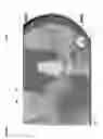 Fig. 02 - Adjusting dental prostheses based on soft tissue