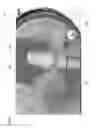 Fig. 08 - Adjusting dental prostheses based on soft tissue