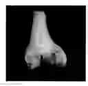 Fig. 01 - Assessing the condition of a joint and devising treatment