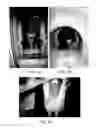 Fig. 06 - Assessing the condition of a joint and devising treatment