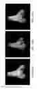 Fig. 07 - Assessing the condition of a joint and devising treatment