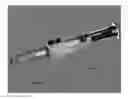 Fig. 02 - INSULIN PEN DATA RECORDING AND TRANSMISSION DEVICE
