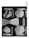 Fig. 06 - Brilliant white cauliflower