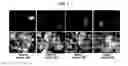 Fig. 02 - Methods for plant transformation using spectinomycin selection