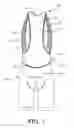 Fig. 05 - One-Piece Article of Clothing