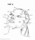 Fig. 04 - FACIAL MASK