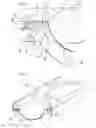 Fig. 03 - Method for producing a basin integrated in a receiving plane, receiving plane for carrying out the method and monobloc assembly obtained by the method