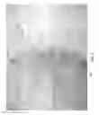 Fig. 07 - Nursing and infant support pillow