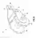 Fig. 05 - Fencing tool