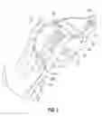 Fig. 06 - Fencing tool