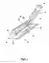 Fig. 02 - Mop Convenient for the Replacement of the Consumptive Material