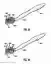 Fig. 21 - Oral care implement