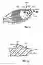 Fig. 30 - Oral care implement