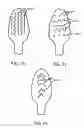 Fig. 38 - Oral care implement