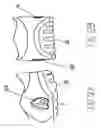 Fig. 06 - PNEUMATICALLY INFLATABLE AIR BLADDER DEVICES CONTAINED ENTIRELY WITHIN SHOE SOLE OR CONFIGURED AS SHOE INSERTS