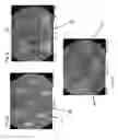 Fig. 04 - Low fiber recirculation filter