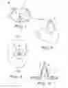 Fig. 04 - Piercing device, particularly for capsules for preparing beverages and the like