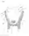 Fig. 02 - Cooking Container and Cooking Method