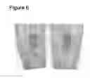 Fig. 07 - Dental repair material