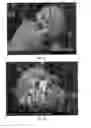 Fig. 07 - Methods and compositions using calcium carbonate