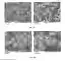 Fig. 15 - Methods and compositions using calcium carbonate