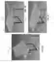 Fig. 31 - Configurable table and methods of use