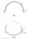 Fig. 05 - Sealable dome assembly