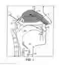 Fig. 02 - NASAL DELIVERY DEVICE