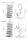 Fig. 04 - Method and system to detect respiratory asynchrony