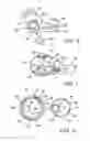 Fig. 06 - Overmolded manifold O-ring