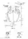 Fig. 03 - Method and device for non-invasive ventilation with nasal interface
