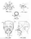Fig. 10 - Method and device for non-invasive ventilation with nasal interface