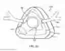 Fig. 12 - Method and device for non-invasive ventilation with nasal interface