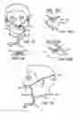 Fig. 16 - Method and device for non-invasive ventilation with nasal interface