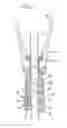 Fig. 08 - Umbrella Having An Improved Locking Mechanism