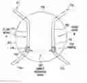 Fig. 01 - Methods and apparatus for moving aliquot samples of fluid