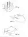 Fig. 08 - Fuel dispensing nozzle hold open clip release assembly