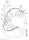 Fig. 28 - Distributed pump self-inflating tire assembly