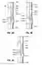 Fig. 08 - DOWNHOLE CATCHER FOR AN ACTUATING BALL AND METHOD