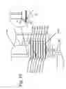 Fig. 14 - Friction drive lift