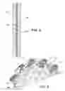 Fig. 08 - Sprocket for easy cleaning